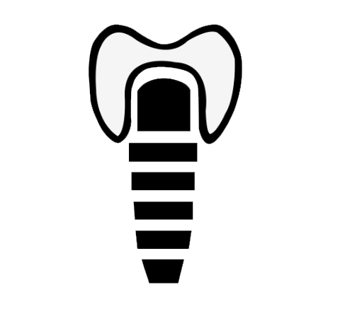 Dental Implant Treatment