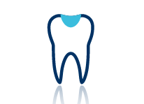 Dental Filling Bonding